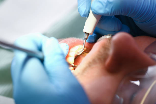 Best Emergency TMJ Treatment in Iraan, TX