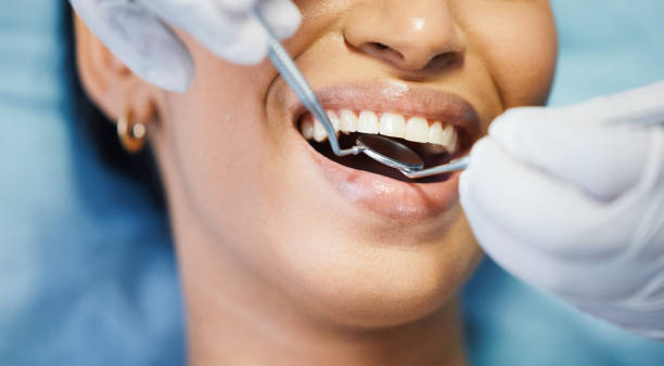 Best Emergency Tooth Extraction in Iraan, TX